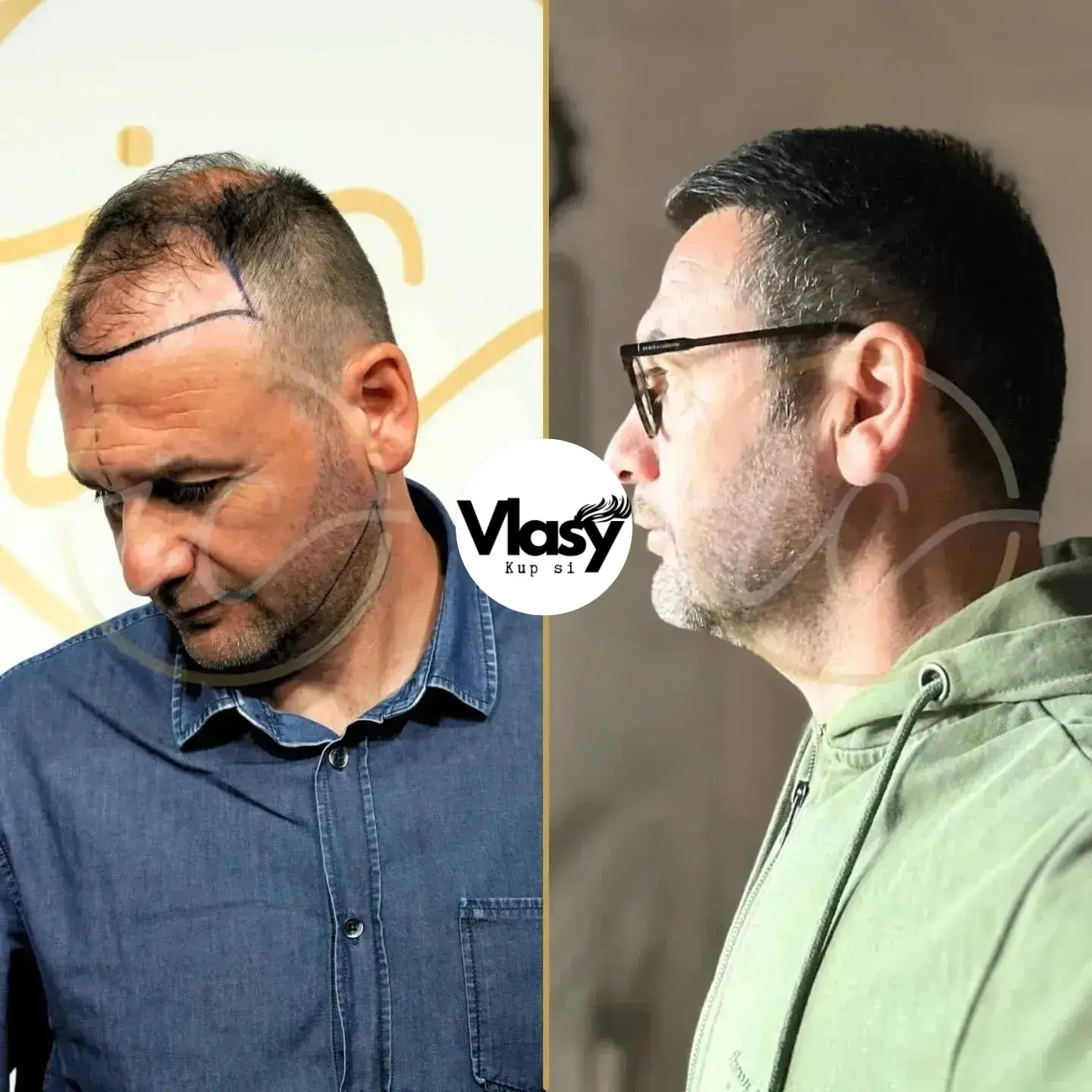 Před a Po 8